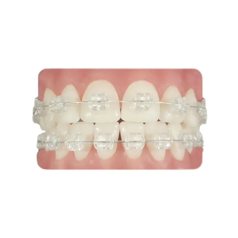 BRACKETS DPG ZAFIRO ROTH 